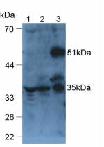 ARP5 / ANGPTL6 Antibody - Western Blot; Sample: Lane1: Mouse Liver Tissue; Lane2: Mouse Heart Tissue; Lane3: Mouse Brain Tissue.