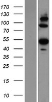 ARP5 / ANGPTL6 Protein - Western validation with an anti-DDK antibody * L: Control HEK293 lysate R: Over-expression lysate