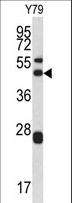 ARPC1A Antibody - Western blot of ARPC1A antibody in Y79 cell line lysates (35 ug/lane). ARPC1A (arrow) was detected using the purified antibody.