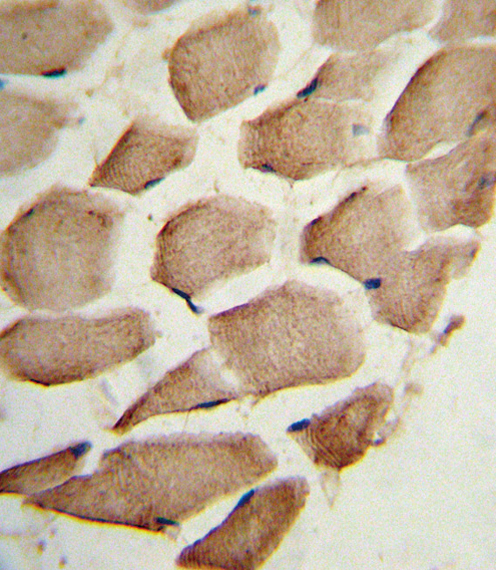 ARPC1A Antibody - Formalin-fixed and paraffin-embedded human skeletal muscle reacted with ARPC1A Antibody , which was peroxidase-conjugated to the secondary antibody, followed by DAB staining. This data demonstrates the use of this antibody for immunohistochemistry; clinical relevance has not been evaluated.