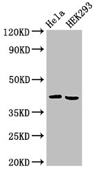ARPC1A Antibody - Positive Western Blot detected in Hela whole cell lysate, HEK293 whole cell lysate. All lanes: ARPC1A antibody at 4 µg/ml Secondary Goat polyclonal to rabbit IgG at 1/50000 dilution. Predicted band size: 42, 39 KDa. Observed band size: 42 KDa