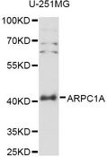 ARPC1A Antibody - Western blot analysis of extracts of U-251MG cells, using ARPC1A antibody at 1:3000 dilution. The secondary antibody used was an HRP Goat Anti-Rabbit IgG (H+L) at 1:10000 dilution. Lysates were loaded 25ug per lane and 3% nonfat dry milk in TBST was used for blocking. An ECL Kit was used for detection and the exposure time was 30s.
