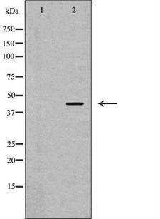 ARPC1A Antibody - Western blot analysis of HeLa whole cells lysates using ARPC1A antibody. The lane on the left is treated with the antigen-specific peptide.