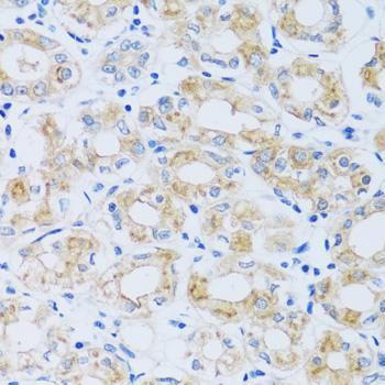 ARPC1A Antibody - Immunohistochemistry of paraffin-embedded Human stomach using ARPC1A Polyclonal Antibody at dilution of 1:100 (40x lens).