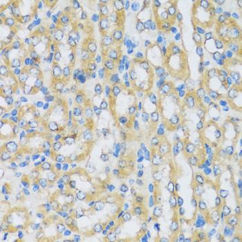 ARPC1A Antibody - Immunohistochemistry of paraffin-embedded Mouse kidney using ARPC1A Polyclonal Antibody at dilution of 1:100 (40x lens).