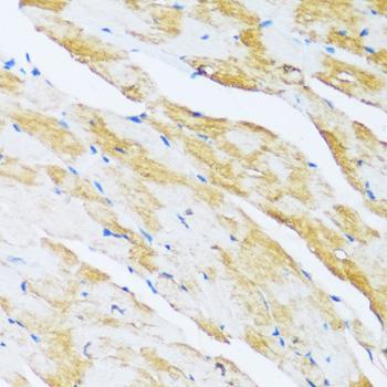 ARPC1A Antibody - Immunohistochemistry of paraffin-embedded Mouse heart using ARPC1A Polyclonal Antibody at dilution of 1:100 (40x lens).