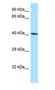 ARPC1B / p41-ARC / ARP2 Antibody - ARPC1B / p41-ARC / ARP2 antibody Western Blot of Fetal Lung.  This image was taken for the unconjugated form of this product. Other forms have not been tested.