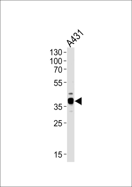 ARPC1B / p41-ARC / ARP2 Antibody - Western blot of lysate from A431 cell line, using ARPC1B Antibody. Antibody was diluted at 1:1000 at each lane. A goat anti-rabbit IgG H&L (HRP) at 1:5000 dilution was used as the secondary antibody. Lysate at 35ug per lane.