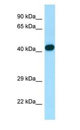 ARPC1B / p41-ARC / ARP2 Antibody - ARPC1B / p41-ARC / ARP2 antibody Western Blot of Fetal Lung.  This image was taken for the unconjugated form of this product. Other forms have not been tested.