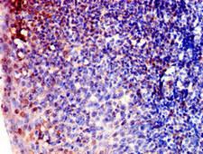 ARPC1B / p41-ARC / ARP2 Antibody - Immunohistochemistry of paraffin-embedded human tonsil tissue at dilution of 1:100