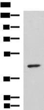 ARPC1B / p41-ARC / ARP2 Antibody - Western blot analysis of Hela cell lysate  using ARPC1B Polyclonal Antibody at dilution of 1:1000