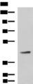 ARPC1B / p41-ARC / ARP2 Antibody - Western blot analysis of Hela cell lysate  using ARPC1B Polyclonal Antibody at dilution of 1:800