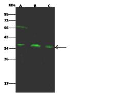 ARPC1B / p41-ARC / ARP2 Antibody - Anti-ARPC1B rabbit polyclonal antibody at 1:500 dilution. Lane A: A431 Whole Cell Lysate. Lane B: Hela Whole Cell Lysate. Lane C: A549 Whole Cell Lysate. Lysates/proteins at 30 ug per lane. Secondary: Goat Anti-Rabbit IgG H&L (Dylight 800) at 1/10000 dilution. Developed using the Odyssey technique. Performed under reducing conditions. Predicted band size: 41 kDa. Observed band size: 37 kDa.