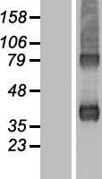 ARPC1B / p41-ARC / ARP2 Protein - Western validation with an anti-DDK antibody * L: Control HEK293 lysate R: Over-expression lysate