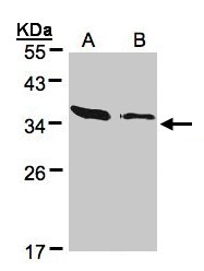 ARPC2 / p34-Arc Antibody - Sample (30 ug of whole cell lysate). A:293T, B: HeLa S3. 12% SDS PAGE. ARPC2 / p34-Arc antibody diluted at 1:500
