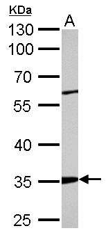 ARPC2 / p34-Arc Antibody - ARPC2 antibody detects ARPC2 protein by Western blot analysis. A. 50 ug mouse kidney lysate/extract. 10 % SDS-PAGE. ARPC2 antibody dilution:1:2000