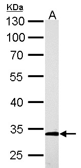 ARPC2 / p34-Arc Antibody - ARPC2 antibody detects ARPC2 protein by Western blot analysis. A. 50 ug rat kidney lysate/extract. 10 % SDS-PAGE. ARPC2 antibody dilution:1:5000