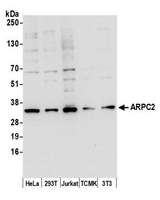 ARPC2 / p34-Arc Antibody - Detection of human and mouse ARPC2 by western blot. Samples: Whole cell lysate (15 µg) from HeLa, HEK293T, Jurkat, mouse TCMK-1, and mouse NIH 3T3 cells prepared using NETN lysis buffer. Antibody: Affinity purified rabbit anti-ARPC2 antibody used for WB at 0.1 µg/ml. Detection: Chemiluminescence with an exposure time of 10 seconds.
