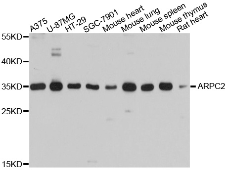 ARPC2 / p34-Arc Antibody - Western blot analysis of extracts of various cell lines, using ARPC2 antibody at 1:1000 dilution. The secondary antibody used was an HRP Goat Anti-Rabbit IgG (H+L) at 1:10000 dilution. Lysates were loaded 25ug per lane and 3% nonfat dry milk in TBST was used for blocking. An ECL Kit was used for detection and the exposure time was 15s.