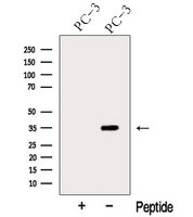 ARPC2 / p34-Arc Antibody - Western blot analysis of extracts of PC-3 cells using ARPC2 antibody. The lane on the left was treated with blocking peptide.