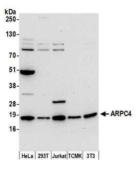 ARPC4 Antibody - Detection of human and mouse ARPC4 by western blot. Samples: Whole cell lysate (15 µg) from HeLa, HEK293T, Jurkat, mouse TCMK-1, and mouse NIH 3T3 cells prepared using NETN lysis buffer. Antibody: Affinity purified rabbit anti-ARPC4 antibody used for WB at 0.1 µg/ml. Detection: Chemiluminescence with an exposure time of 30 seconds.