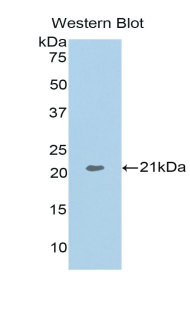 ARPC4 Antibody - Western blot of recombinant ARPC4.  This image was taken for the unconjugated form of this product. Other forms have not been tested.