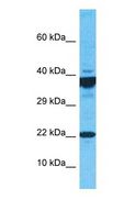 ARPC4 Antibody - Western blot of ARPC4 Antibody with human MCF7 Whole Cell lysate.  This image was taken for the unconjugated form of this product. Other forms have not been tested.