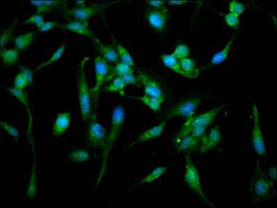 ARPC4 Antibody - Immunofluorescence staining of Hela cells at a dilution of 1:100, counter-stained with DAPI. The cells were fixed in 4% formaldehyde, permeabilized using 0.2% Triton X-100 and blocked in 10% normal Goat Serum. The cells were then incubated with the antibody overnight at 4 °C.The secondary antibody was Alexa Fluor 488-congugated AffiniPure Goat Anti-Rabbit IgG (H+L) .