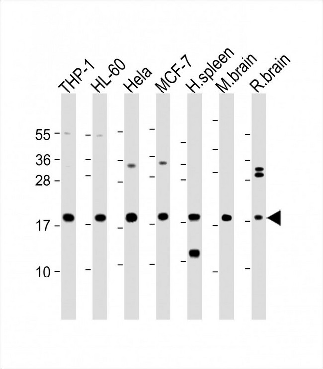 ARPC5 / p16-Arc Antibody - All lanes: Anti-ARPC5 Antibody (Center) at 1:2000 dilution Lane 1: THP-1 whole cell lysate Lane 2: HL-60 whole cell lysate Lane 3: Hela whole cell lysate Lane 4: MCF-7 whole cell lysate Lane 5: Human spleen lysate Lane 6: Mouse brain lysate Lane 7: Rat brain lysate Lysates/proteins at 20 µg per lane. Secondary Goat Anti-Rabbit IgG, (H+L), Peroxidase conjugated at 1/10000 dilution. Predicted band size: 16 kDa Blocking/Dilution buffer: 5% NFDM/TBST.