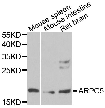 ARPC5 / p16-Arc Antibody - Western blot analysis of extracts of various cells.