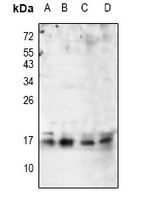 ARPC5 / p16-Arc Antibody - Western blot analysis of p16 ARC expression in Hela (A), MCF7 (B), mouse embryo (C), rat ovary (D) whole cell lysates.