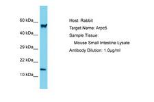 ARPC5 / p16-Arc Antibody -  This image was taken for the unconjugated form of this product. Other forms have not been tested.