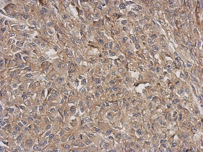 ARPC5L Antibody - IHC of paraffin-embedded RT2 xenograft, using ARPC5L antibody at 1:500 dilution.