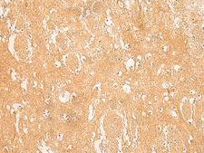 ARPC5L Antibody - Immunohistochemistry of paraffin-embedded Human brain tissue  using ARPC5L Polyclonal Antibody at dilution of 1:45(×200)