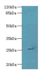 ARPIN / C15orf38 Antibody - Western blot. All lanes: ARPIN antibody at 0.5 ug/ml+Heo-2 whole cell lysate Goat polyclonal to rabbit at 1:10000 dilution. Predicted band size: 25 kDa. Observed band size: 25 kDa.