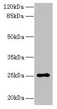 ARPIN / C15orf38 Antibody - Western blot All lanes: ARPIN antibody at 0.5µg/ml + HepG2 whole cell lysate Secondary Goat polyclonal to rabbit IgG at 1/10000 dilution Predicted band size: 25, 44 kDa Observed band size: 25 kDa