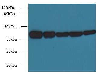 ARPM1 Antibody - Western blot. All lanes: ACTRT3 antibody at 2.5 ug/ml. Lane 1: MCF7 whole cell lysate. Lane 2: HCT116 whole cell lysate. Lane 3: K562 whole cell lysate. Lane 4: 293T whole cell lysate. Lane 5: HeLa whole cell lysate. Secondary antibody: Goat polyclonal to Rabbit IgG at 1:10000 dilution. Predicted band size: 41 kDa. Observed band size: 41 kDa.