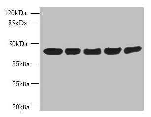 ARPM1 Antibody - Western blot All lanes: ACTRT3 antibody at 2.5µg/ml Lane 1: MCF-7 whole cell lysate Lane 2: HCT116 whole cell lysate Lane 3: K562 whole cell lysate Lane 4: 293T whole cell lysate Lane 5: Hela whole cell lysate Secondary Goat polyclonal to rabbit IgG at 1/10000 dilution Predicted band size: 42 kDa Observed band size: 42 kDa