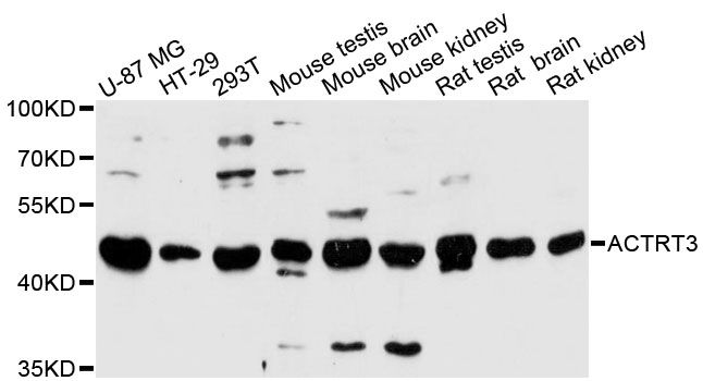 ARPM1 Antibody - Western blot analysis of extracts of various cell lines, using ACTRT3 antibody at 1:3000 dilution. The secondary antibody used was an HRP Goat Anti-Rabbit IgG (H+L) at 1:10000 dilution. Lysates were loaded 25ug per lane and 3% nonfat dry milk in TBST was used for blocking. An ECL Kit was used for detection and the exposure time was 30s.