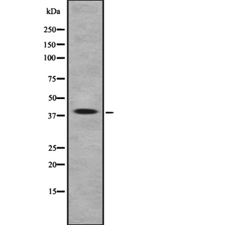 ARR3 / Cone Arrestin Antibody - Western blot analysis of Arrestin-C using LOVO cells whole cells lysates