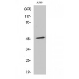 ARRB1 / Beta Arrestin 1 Antibody - Western blot of Arrestin-beta-1 antibody