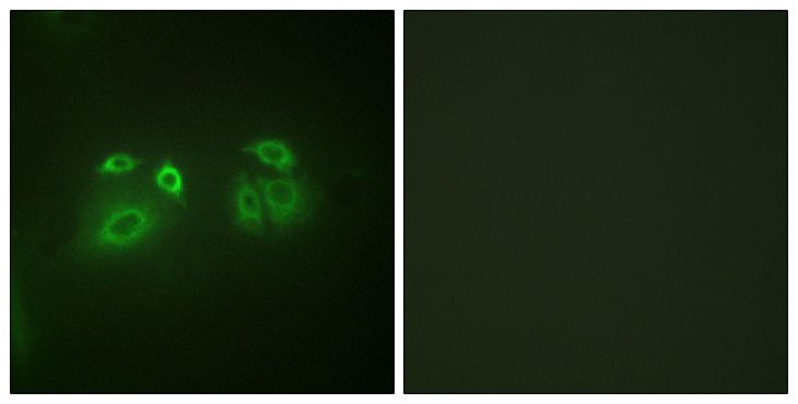 ARRB1 / Beta Arrestin 1 Antibody - Immunofluorescence analysis of A549 cells, using Arrestin 1 Antibody. The picture on the right is blocked with the synthesized peptide.