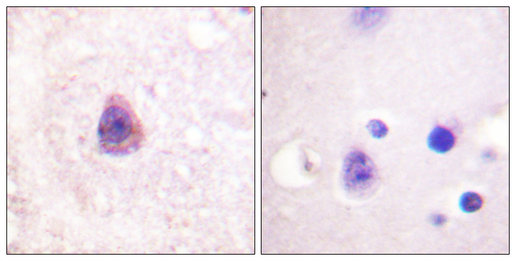 ARRB1 / Beta Arrestin 1 Antibody - Immunohistochemistry analysis of paraffin-embedded human brain tissue, using Arrestin 1 Antibody. The picture on the right is blocked with the synthesized peptide.