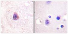 ARRB1 / Beta Arrestin 1 Antibody - Immunohistochemistry analysis of paraffin-embedded human brain tissue, using Arrestin 1 Antibody. The picture on the right is blocked with the synthesized peptide.