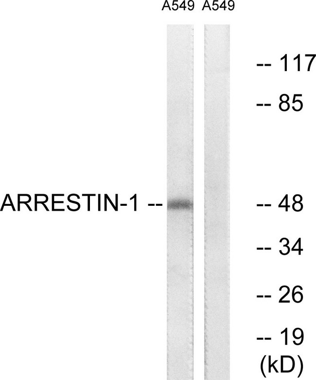 ARRB1 / Beta Arrestin 1 Antibody - Western blot analysis of lysates from A549 cells, treated with Etoposide 25uM 60', using Arrestin 1 Antibody. The lane on the right is blocked with the synthesized peptide.