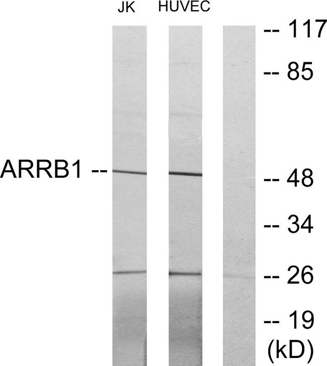 ARRB1 / Beta Arrestin 1 Antibody - Western blot analysis of lysates from Jurkat and HUVEC cells, using ARRB1 Antibody. The lane on the right is blocked with the synthesized peptide.