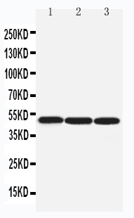 ARRB1 / Beta Arrestin 1 Antibody - WB of ARRB1 / Beta Arrestin 1 antibody. Lane 1: Rat Lung Tissue Lysate. Lane 2: Rat Skeletal Muscle Tissue Lysate. Lane 3: SW620 Cell Lysate.