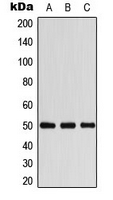ARRB1 / Beta Arrestin 1 Antibody - Western blot analysis of Beta-arrestin-1 expression in MCF7 (A); mouse brain (B); H9C2 (C) whole cell lysates.
