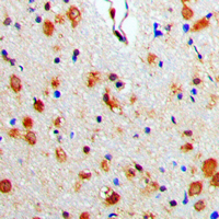 ARRB1 / Beta Arrestin 1 Antibody - Immunohistochemical analysis of Beta-arrestin-1 staining in human brain formalin fixed paraffin embedded tissue section. The section was pre-treated using heat mediated antigen retrieval with sodium citrate buffer (pH 6.0). The section was then incubated with the antibody at room temperature and detected using an HRP conjugated compact polymer system. DAB was used as the chromogen. The section was then counterstained with hematoxylin and mounted with DPX.