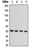 ARRB1 / Beta Arrestin 1 Antibody - Western blot analysis of Beta-arrestin-1 expression in HeLa (A); A549 (B); mouse brain (C); rat brain (D) whole cell lysates.